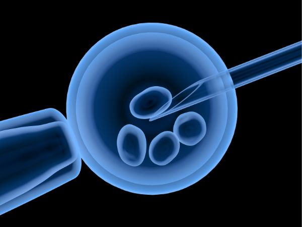 What is Frozen Embryo Transfer?
